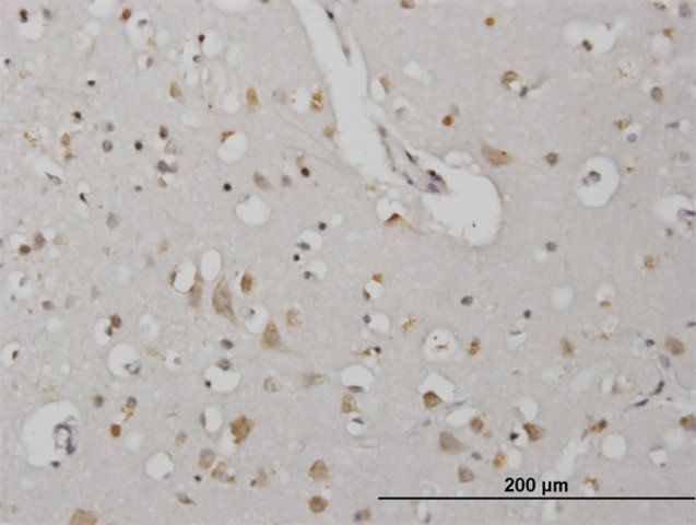 Monoclonal Anti-CDKL2 antibody produced in mouse