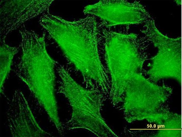 Monoclonal Anti-CDC42BPB antibody produced in mouse