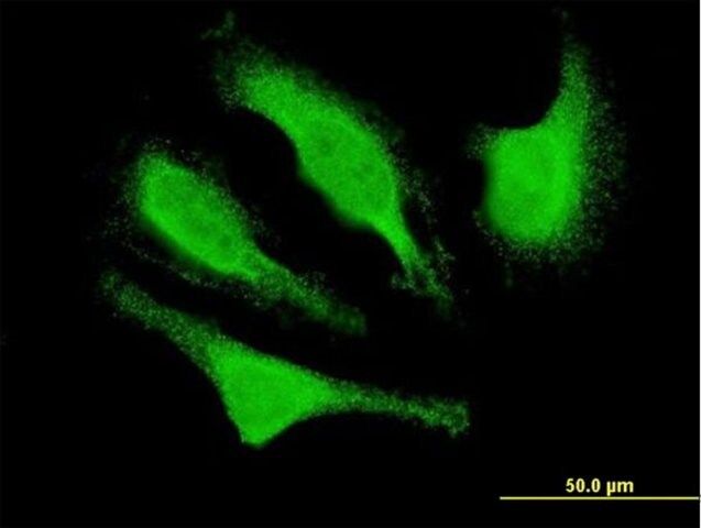 Monoclonal Anti-CDK5R1 antibody produced in mouse