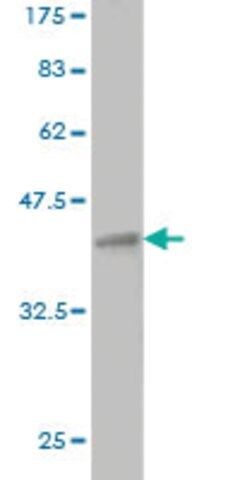 Monoclonal Anti-CHRNE antibody produced in mouse