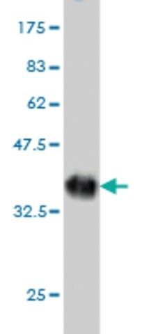 Monoclonal Anti-CYorf15B antibody produced in mouse