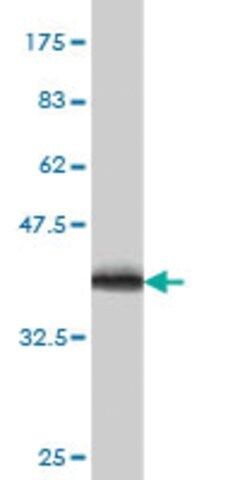 Monoclonal Anti-CYB5R4 antibody produced in mouse