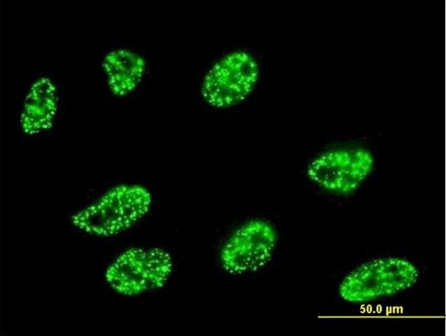 Monoclonal Anti-DLL1 antibody produced in mouse