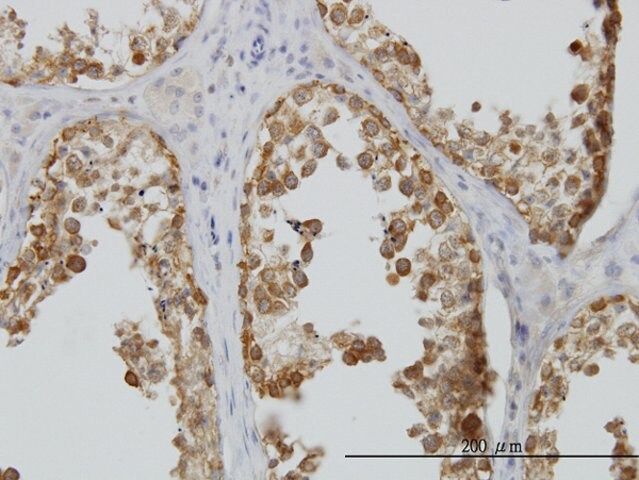 Monoclonal Anti-DDX6 antibody produced in mouse