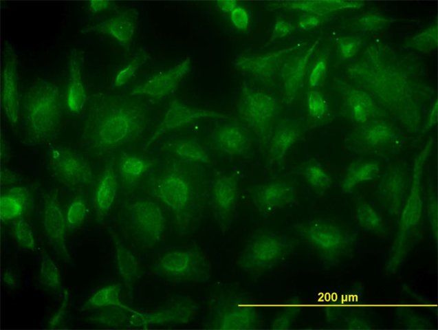 Monoclonal Anti-CKB antibody produced in mouse