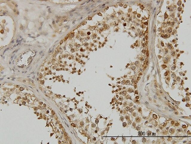 Monoclonal Anti-DDX3Y antibody produced in mouse