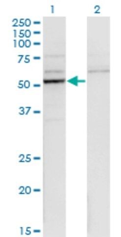 Monoclonal Anti-CYP26B1 antibody produced in mouse