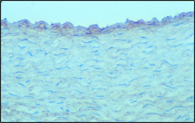 Monoclonal Anti-Chondroitin Sulfate antibody produced in mouse