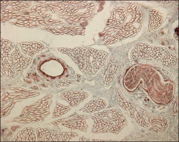 Monoclonal Anti-Collagen, Type IV antibody produced in mouse