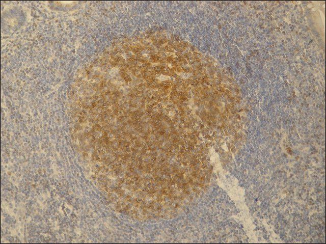 Monoclonal Anti-PAG / Cbp antibody produced in mouse