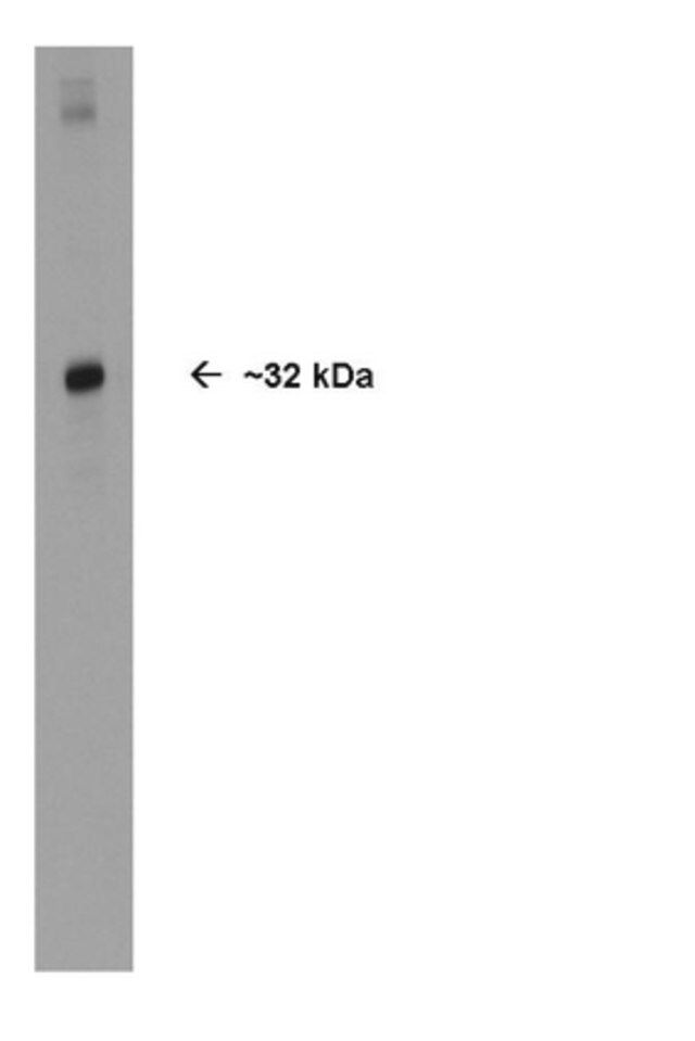 Anti-Olig2 Antibody