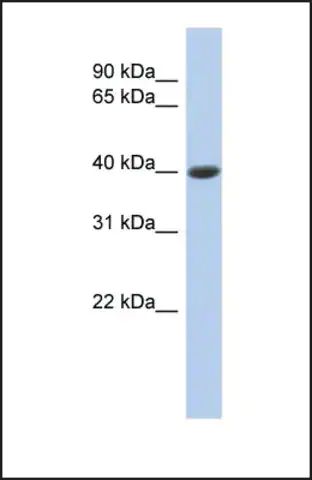 Anti-CPB1, (N-terminal) antibody produced in rabbit