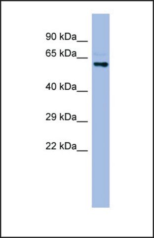 Anti-CYP4A22, (N-terminal) antibody produced in rabbit