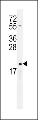 ANTI-CYBA (C-TERM) antibody produced in rabbit