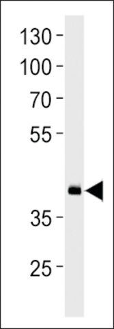 ANTI-DANRE HOXD11A (CENTER) antibody produced in rabbit