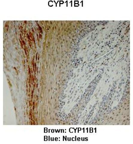 Anti-CYP11B1 antibody produced in rabbit