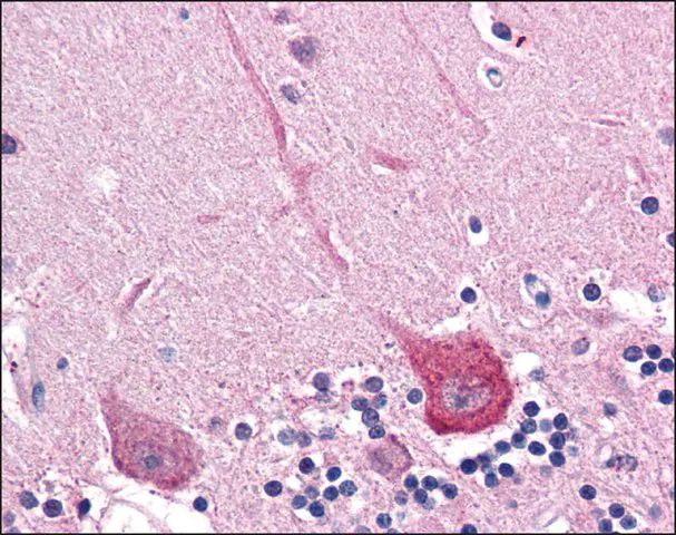 Anti-DLGAP2 antibody produced in rabbit