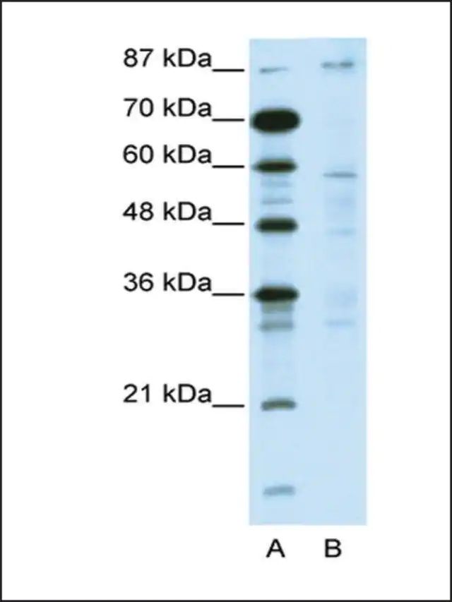 Anti-DMAP1 (AB3) antibody produced in rabbit