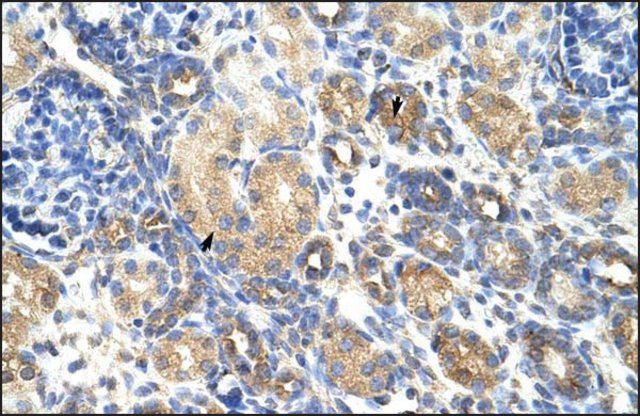 Anti-GNB1L antibody produced in rabbit