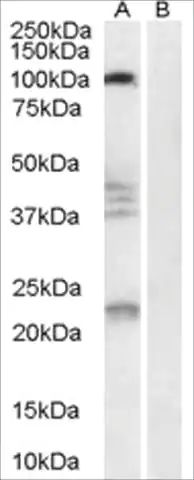 Anti-NOGO 66 Receptor antibody produced in goat