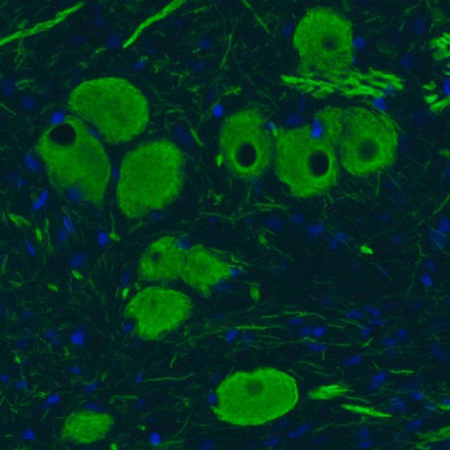 Monoclonal Anti-NEFM antibody produced in mouse