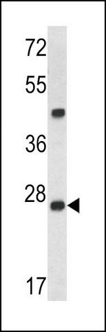 Anti-dcr-1 (center) antibody produced in rabbit