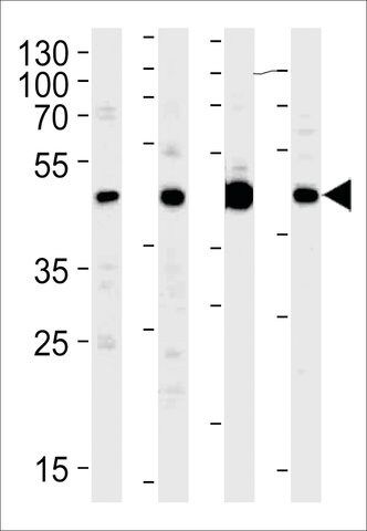 ANTI-MEK1 (MAP2K1)(N-TERMINAL) antibody produced in rabbit