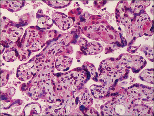 Anti-MED28 antibody produced in rabbit