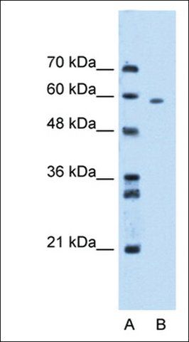 Anti-MDM4 antibody produced in rabbit