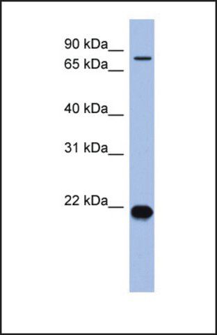 Anti-ZNF800, (N-terminal) antibody produced in rabbit