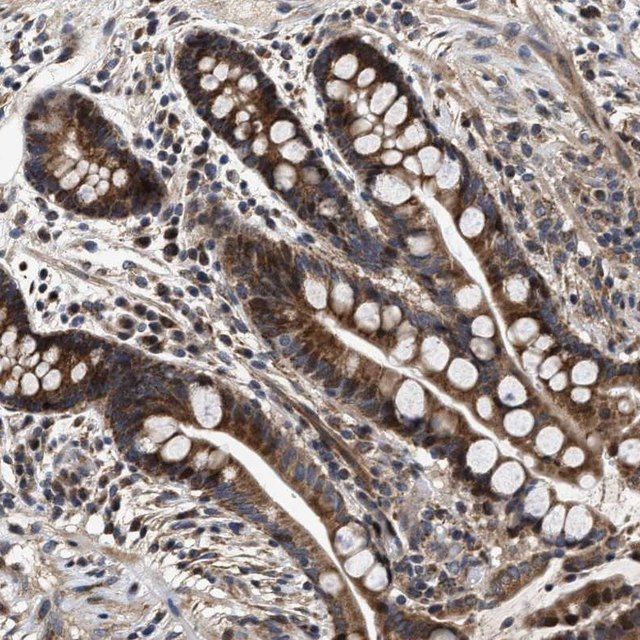 Anti-SCYL2 antibody produced in rabbit