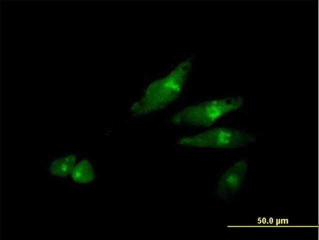 Anti-SCYL3 antibody produced in mouse