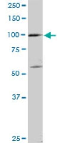 Anti-SCYL2 antibody produced in rabbit