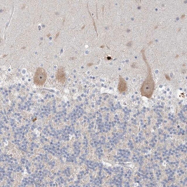 Anti-SDAD1 antibody produced in rabbit