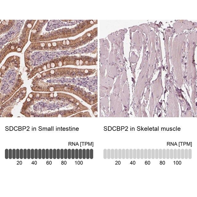 Anti-SDCBP2