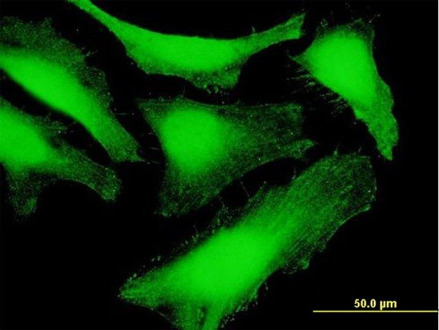 Anti-SDCBP antibody produced in mouse