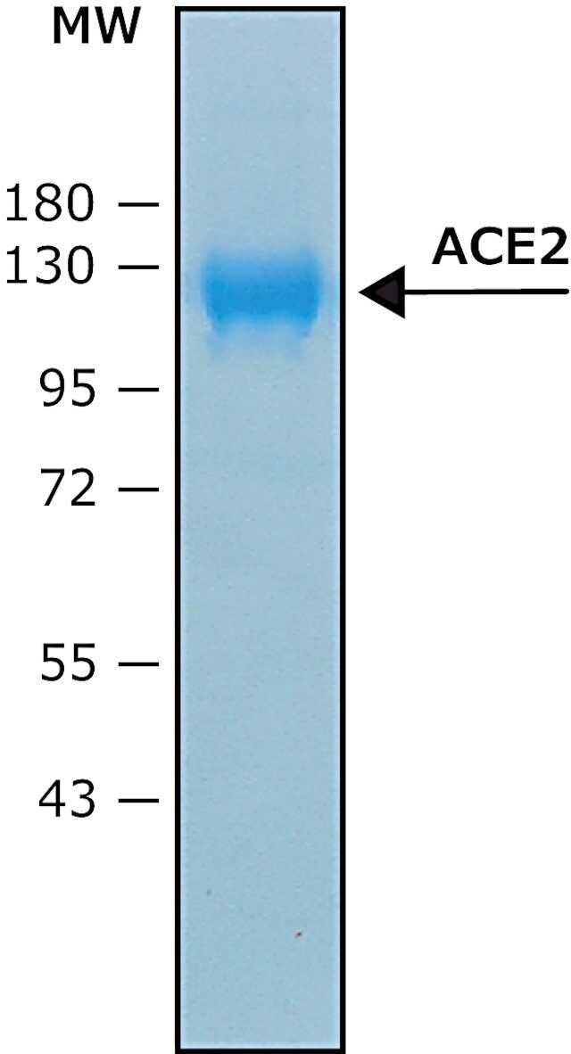 Angiotensin Converting Enzyme-2, ACE2
