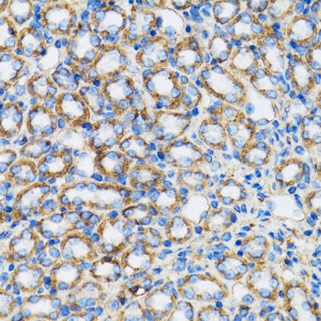 Anti- α-Catenin antibody produced in rabbit