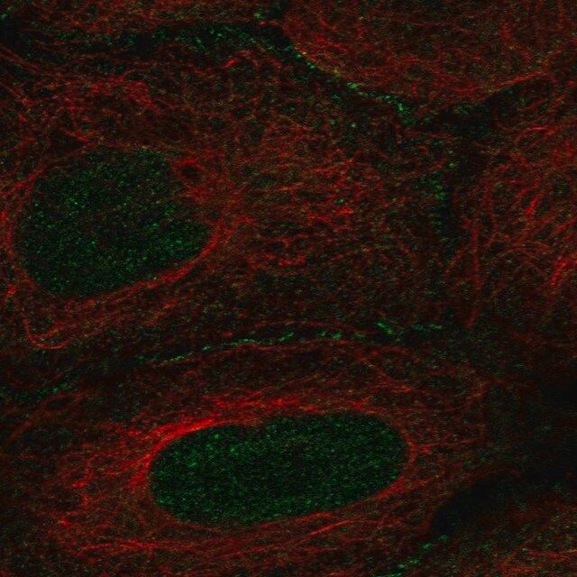 Anti-AMOT antibody produced in rabbit