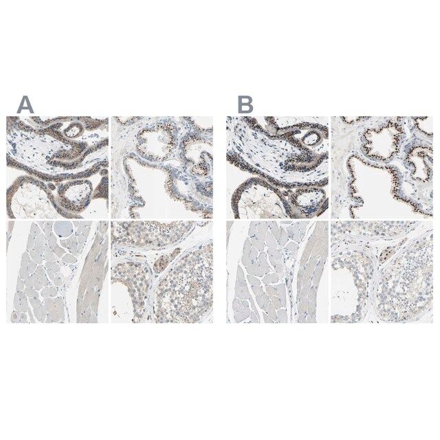 Anti-B4GALT1 antibody produced in rabbit