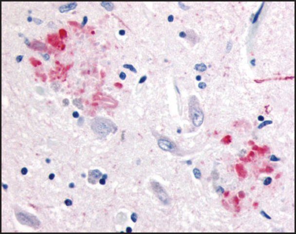 Anti-APP antibody produced in rabbit