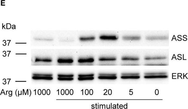 Anti-ASS1 antibody produced in rabbit