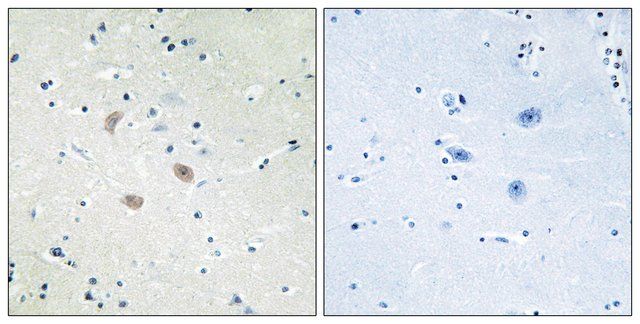 Anti-AKT2 antibody produced in rabbit